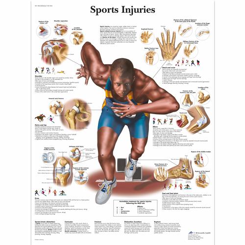 Anatomisk planche: Sportsskader, lamineret
