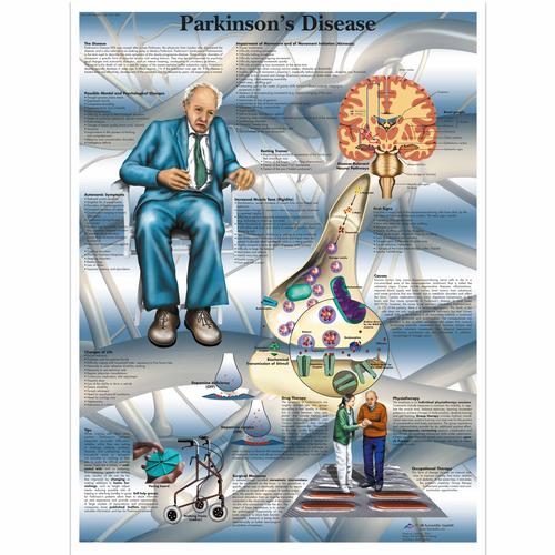 Anatomisk planche: Parkinsons sygdom, lamineret