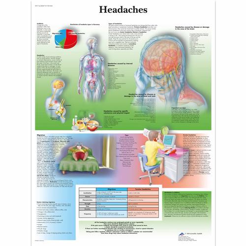 Anatomisk planche: Hovedpine, lamineret