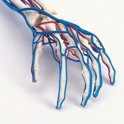 Vaskulær arm – billede 2