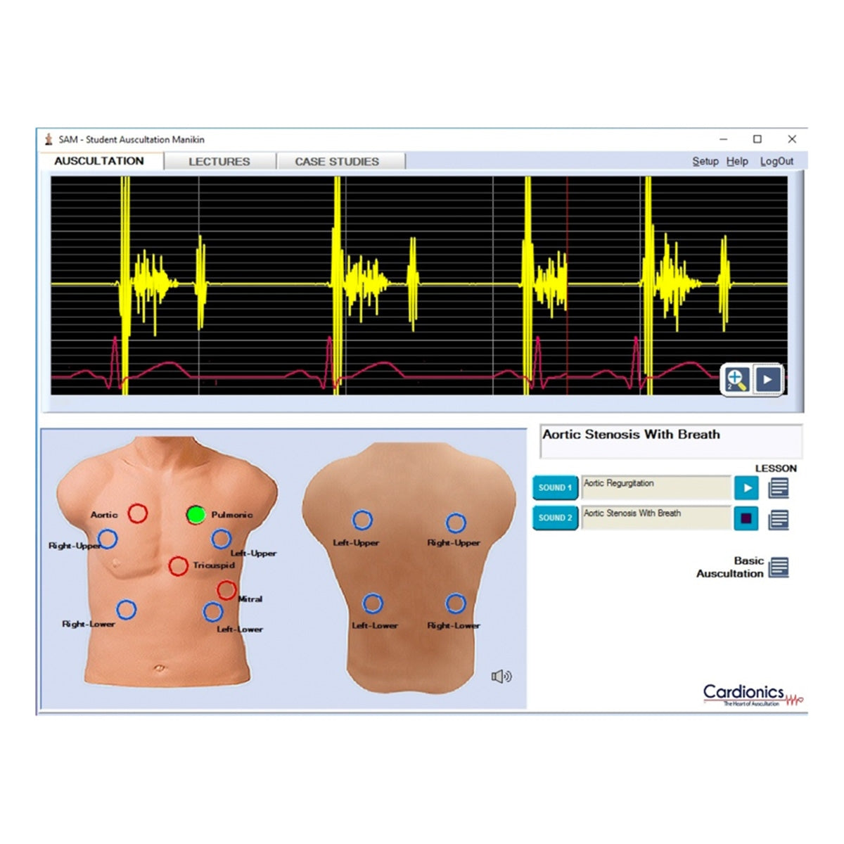 SAM 3G – Student Auskultation Manikin 3:e generationen