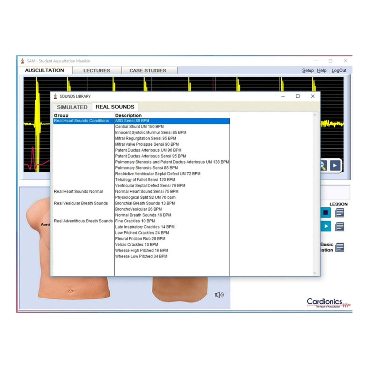 SAM 3G – Student Auskultation Manikin 3:e generationen