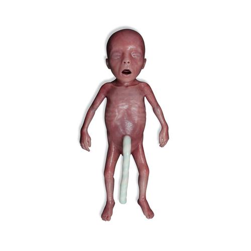 Lifecast Mikro-Præterm Født Baby / Ekstremt Lav Fødselvægt (ELBW)