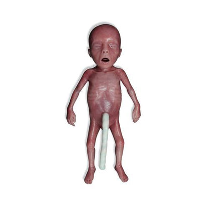 Lifecast Mikro-Præterm Født Baby / Ekstremt Lav Fødselvægt (ELBW)