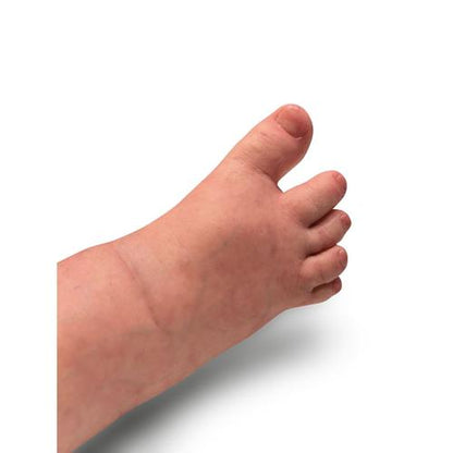 Lifecast Barn med Downs Syndrom (Gwen)