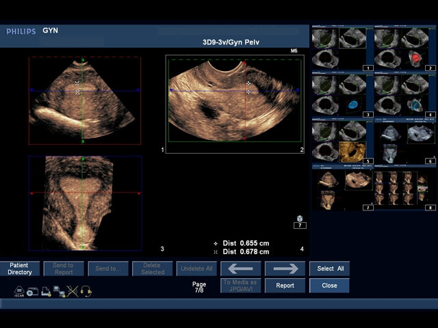 Blå Fantom ultraljudsträningsmodell IUP Utomkvedshavandeskap Transvaginal