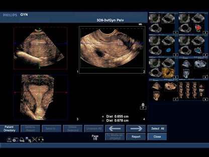 Blå Fantom ultraljudsträningsmodell IUP Utomkvedshavandeskap Transvaginal