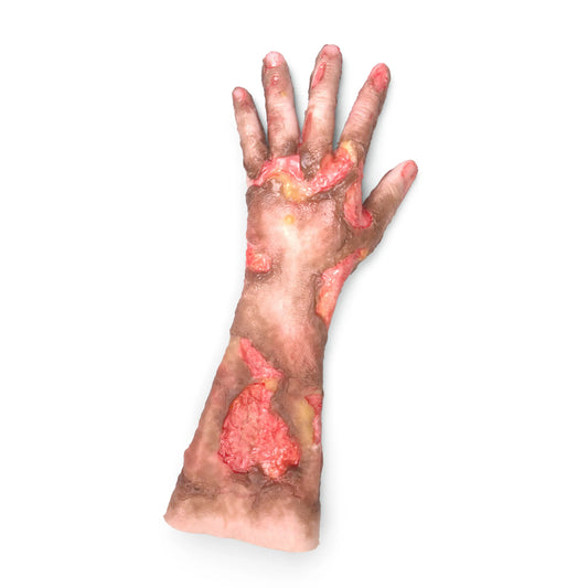 MB210-L-P-L Bränd Arm - Realistisk Brännskadesimulering