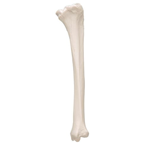 Model af skinneben (tibia) – billede 5