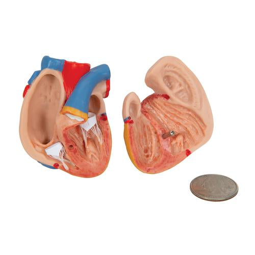 Mini Torso 12 dele