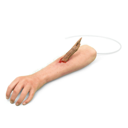 Arm med främmande kropp - Blödning