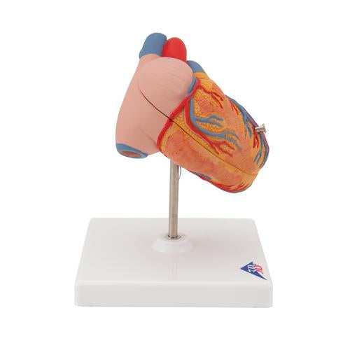 Hjertemodel Classic med venstresidig hypertrofi (LVH), 2 dele – billede 2