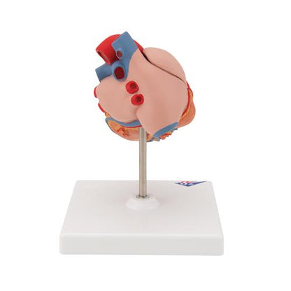 Hjertemodel Classic med venstresidig hypertrofi (LVH), 2 dele – billede 3