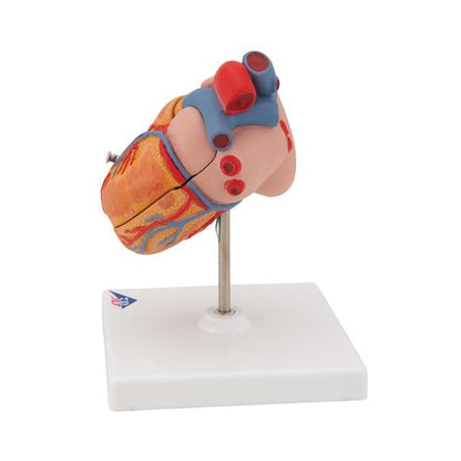 Hjertemodel Classic med venstresidig hypertrofi (LVH), 2 dele – billede 4