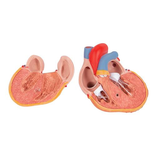 Hjertemodel Classic med venstresidig hypertrofi (LVH), 2 dele – billede 6