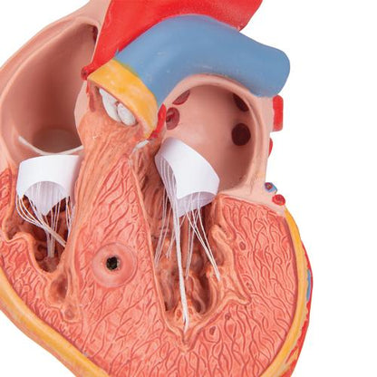 Hjertemodel Classic med venstresidig hypertrofi (LVH), 2 dele – billede 7