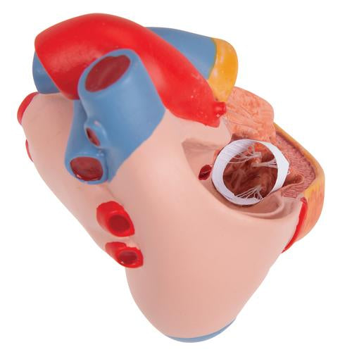 Hjertemodel Classic med venstresidig hypertrofi (LVH), 2 dele – billede 8