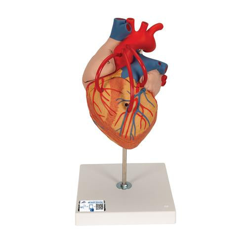 Hjertemodel med bypass, 2x naturlig størrelse, 4 dele