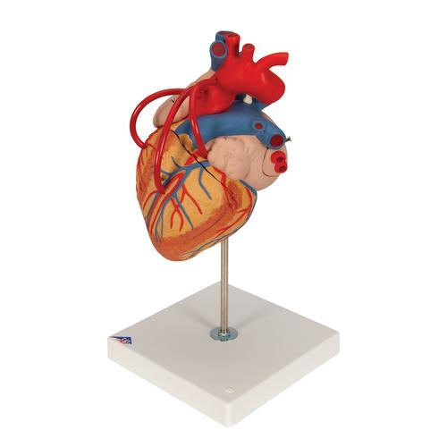 Hjertemodel med bypass, 2x naturlig størrelse, 4 dele – billede 6