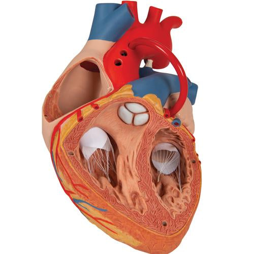 Hjertemodel med bypass, 2x naturlig størrelse, 4 dele – billede 7