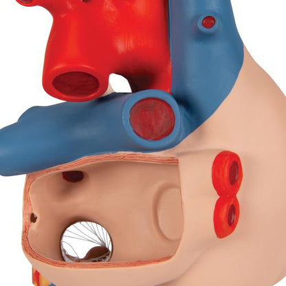 Hjertemodel med bypass, 2x naturlig størrelse, 4 dele – billede 8