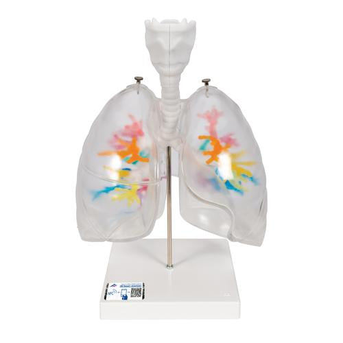 CT-bronkietræ med strubehoved og transparente lunger