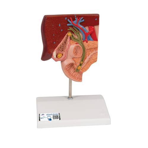Galdestensmodel
