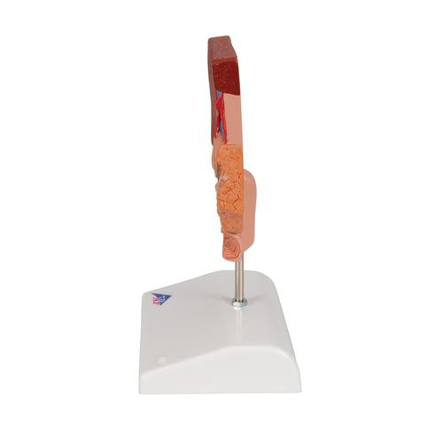 Galdestensmodel – billede 4