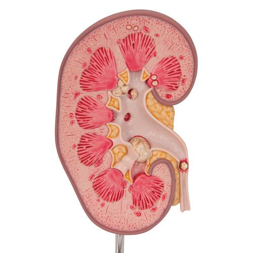 Nyrestensmodel – billede 7