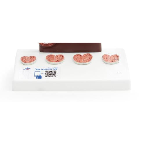 Prostatamodel, 1/2 naturlig størrelse, mørk hudtone – billede 4