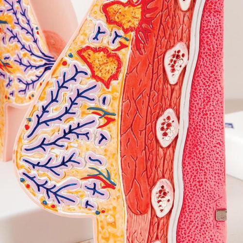 Model af kvindebryst med sundt og sygt væv – billede 4