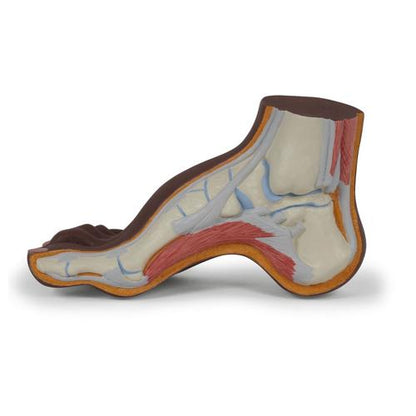 Fodmodel med hulfod (pes cavus), mørk hudtone