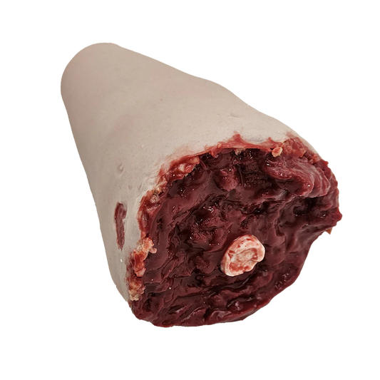 Amputation av benstump