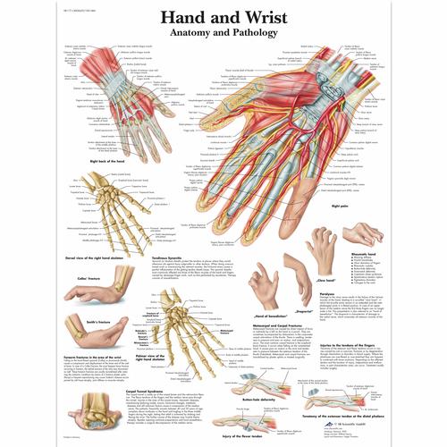 Anatomisk planche: Hånd og håndled – anatomi og patologi, papir