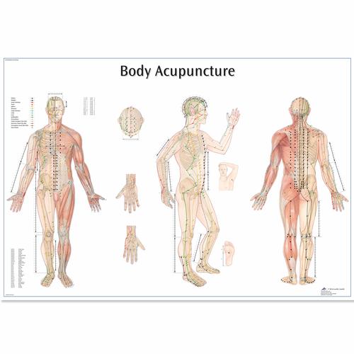 Anatomisk planche: Kropsakupunktur, lamineret