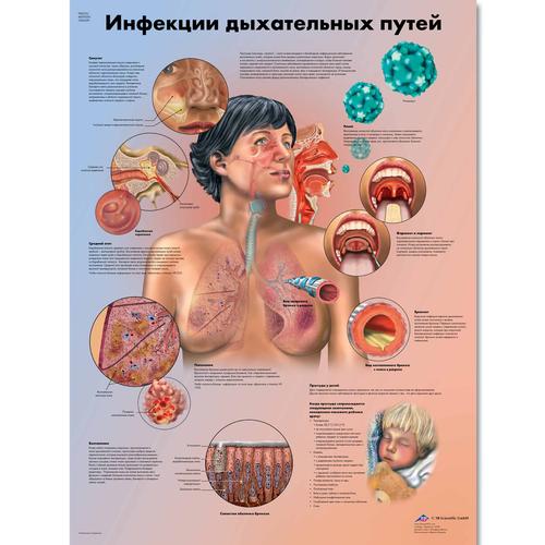 Anatomisk planche: Luftvejsinfektioner, lamineret med metaløjer