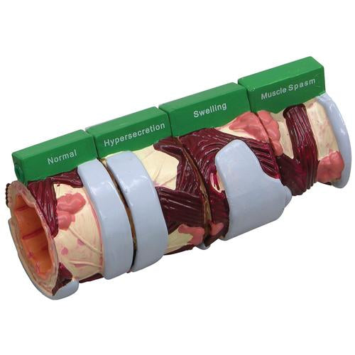 4-Piece Bronchus Model