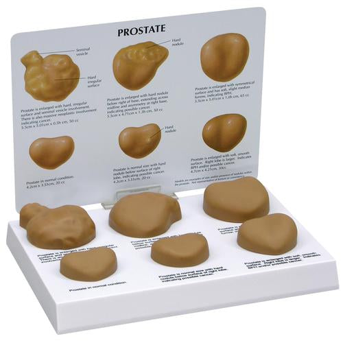 Prostatamodel
