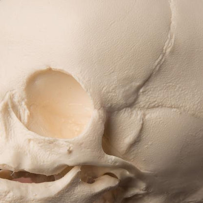 Foster Skull