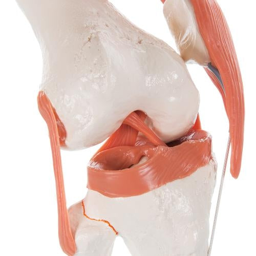 Knä med ligament
