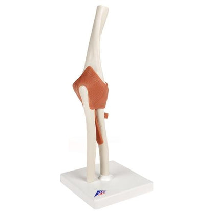 Armbåge med ligament
