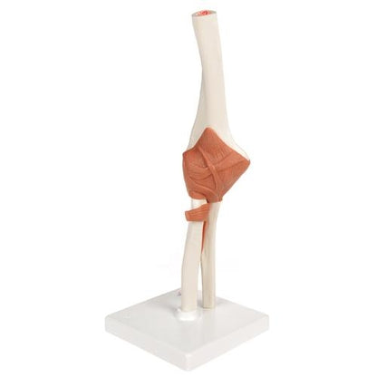 Armbåge med ligament