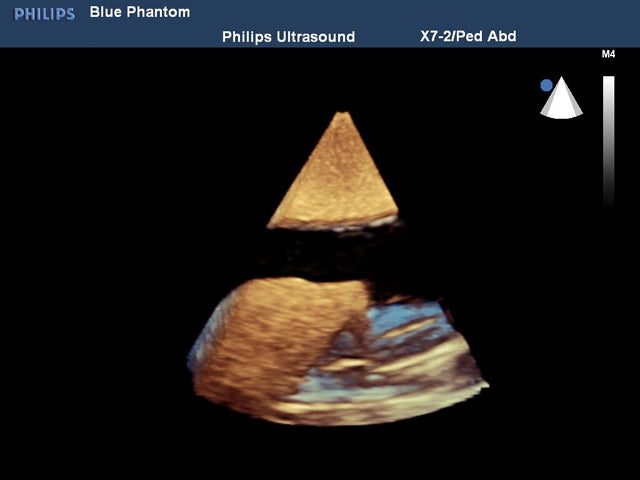 BluePhantom ersättningsvävnad för thorakocentes ultraljudsträningsmodell