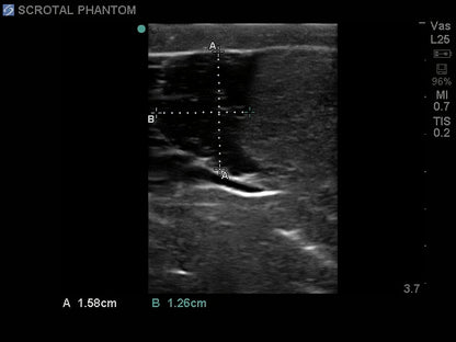 Blue Phantom ultraljudsträningsmodell för skrotal ultraljud