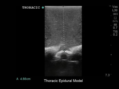 BluePhantom ersättningsvävnad för thorakal epidural-ultraljudsmodell