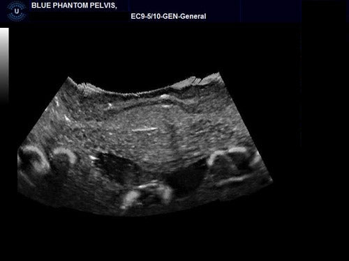 BluePhantom transvaginal ultraljudsträningsmodell för sonohysterografi och sonosalpingografi