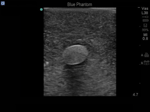 Blue Phantom Femoral kärl- och nerversättningstextur