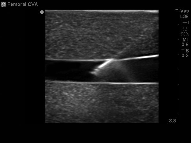 BluePhantom ersättningsvävnad för femoral kärlåtkomst