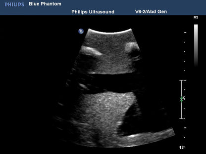 BluePhantom ersättningsvävnad för thorakocentes ultraljudsträningsmodell