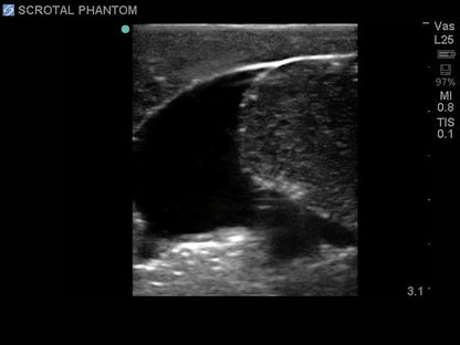 Blue Phantom ultraljudsträningsmodell för skrotal ultraljud